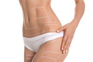 clinicas cirugia estetica caracas Dra. Francy Belandria. Cirujano Plástico