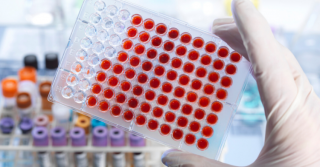 Muestras de sangre en laboratorio.