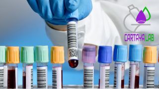 analisis aliento caracas CARTAYALAB